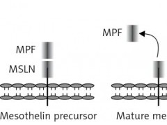 什么是间皮素(MSLN),靶向间皮素的新药新疗法有哪些