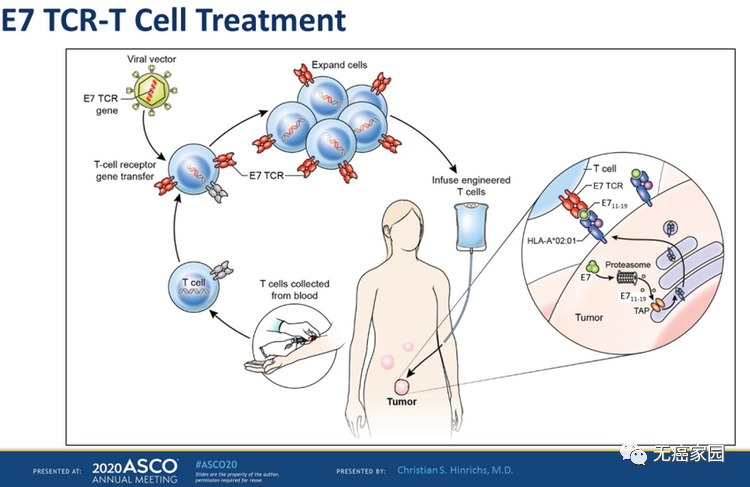 E7 TCR-T疗法