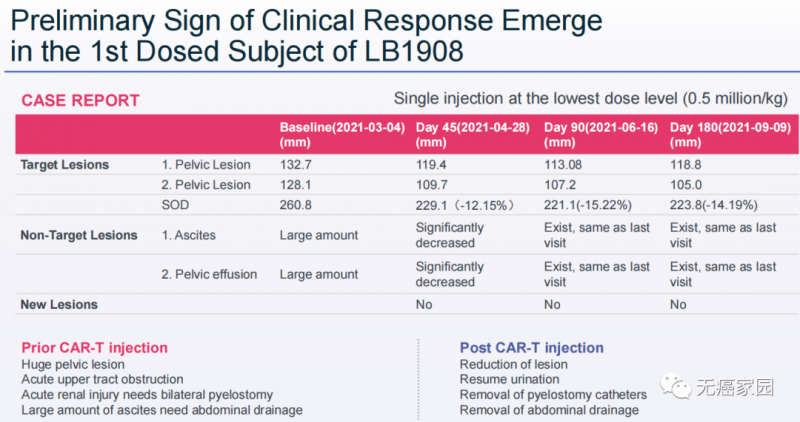 CAR-T疗法LB1908治疗数据