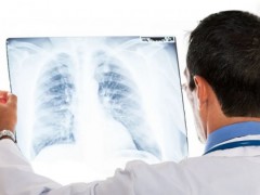 肺部微小结节怎么办,如何判断肺结节是良性还是恶性