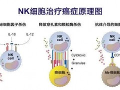 细胞免疫疗法,肿瘤细胞免疫治疗的新方向-CAR-NK细胞疗法