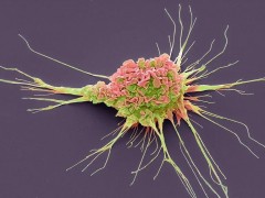 树突状(DC)细胞是什么,树突(DC)细胞疫苗,DC细胞的作用,DC细胞免疫疗法