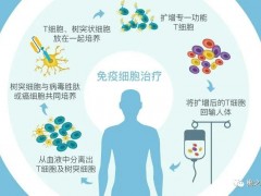 细胞免疫疗法,什么是免疫细胞,免疫细胞有哪些分类,细胞免疫治疗有副作用吗等十个细胞免疫治疗的问题简析