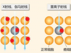 质子重离子疗法,质子重离子可以治疗哪些肿瘤癌症