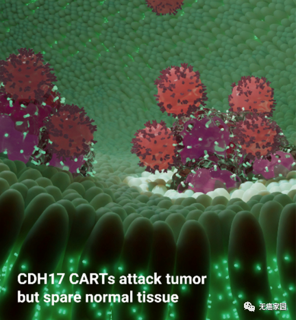CDH17 CAR-T攻击癌细胞