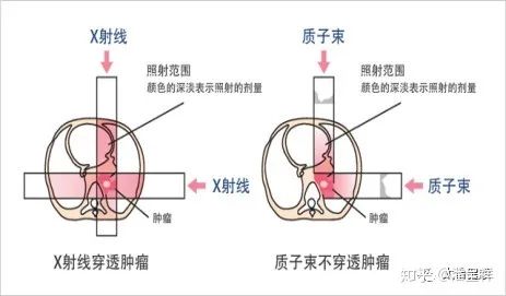 X射线和质子线对比