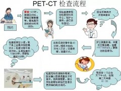 PETCT是什么,PET-CT检查流程和PETCT优势的是什么