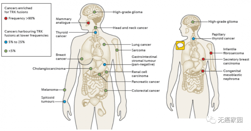 NTRK融合在成人和儿童肿瘤中的分布和频率