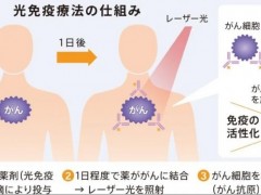 号称"第五种癌症疗法的"光免疫疗法Akalux在日本获批上市,什么是光免疫疗法,光免疫治疗的原理是什么