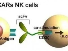 CAR-NK细胞疗法,CARNK治疗12年化疗失败、干细胞移植后复发的患者,最终让患者完全缓解