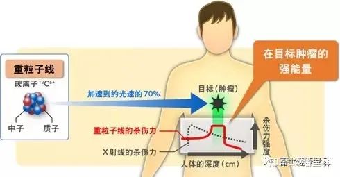 质子重离子治疗的原理