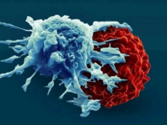 NK细胞疗法治疗癌症肿瘤的探索