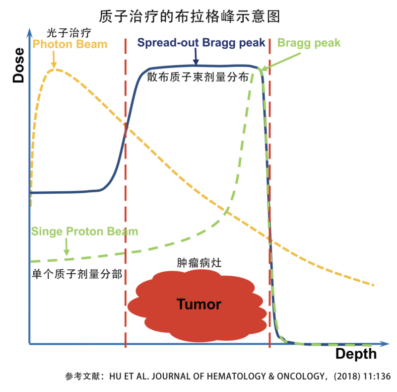 质子治疗的布拉格峰示意图