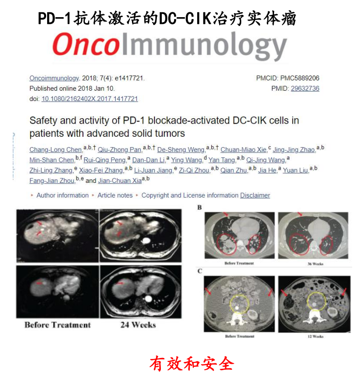 CIK细胞疗法治疗实体瘤的效果