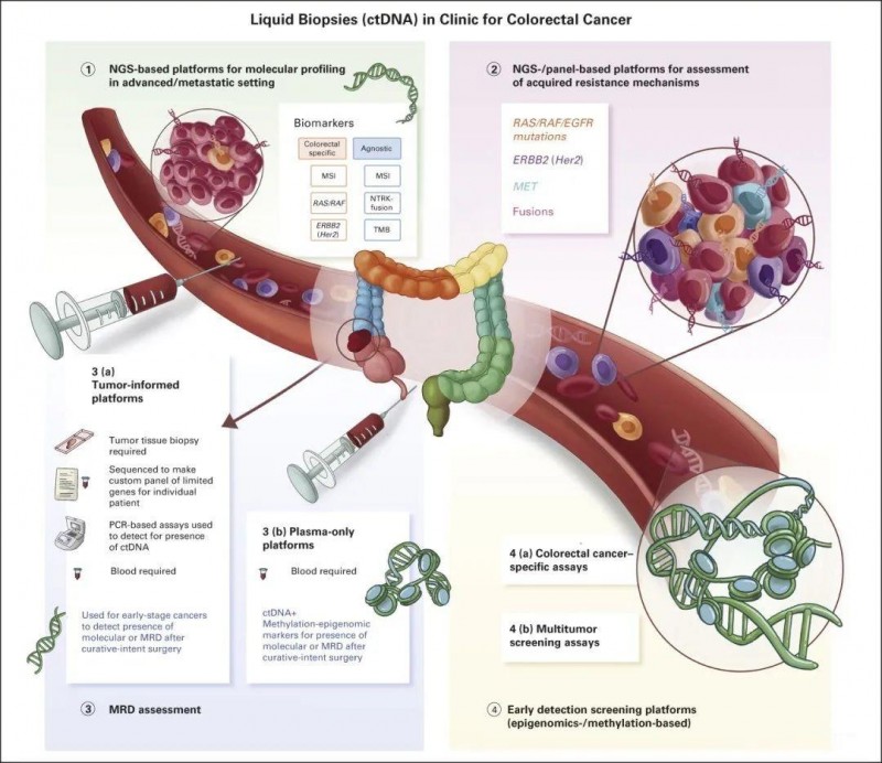 ctDNA在结直肠癌中的临床应用场景