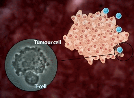 TIL免疫细胞杀伤癌细胞