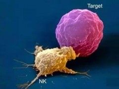 NK细胞疗法治疗效果怎么样,60例自然杀伤细胞治疗恶性肿瘤的临床疗效评价