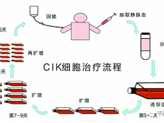 化疗太痛苦,不想化了,怎么办,CIK细胞免疫疗法让癌症患者摆脱化疗之苦