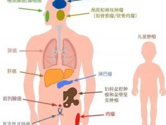 质子重离子适应症