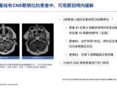 EGFR靶向药,多款国内外EGFR抑制剂助力攻克非小细胞肺癌罕见的EGFR外显子20插入突变(EGFR ex20in)