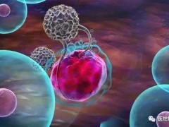 NK细胞疗法-重新激活NK细胞,肿瘤缩小近80%