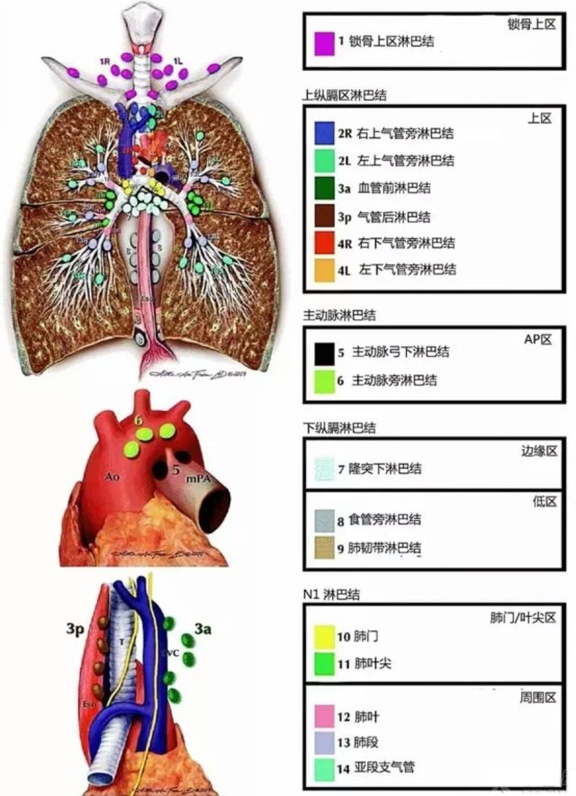 肺癌纵膈淋巴结勾画分区