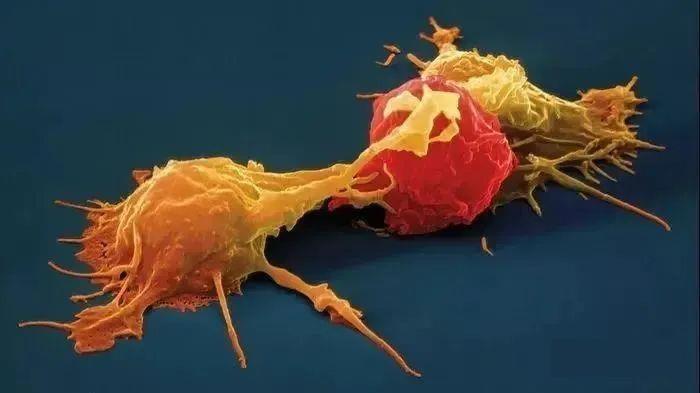 NK细胞正在攻击癌细胞