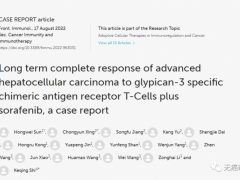 GPC3CART疗法CT011治疗晚期肝癌患者无癌超3年