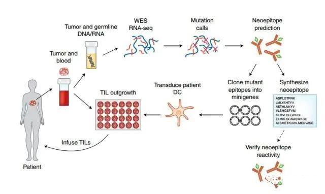 TILs疗法的治疗流程