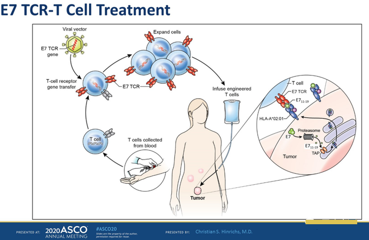 E7 TCR-T细胞治疗过程