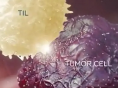 TILs细胞免疫疗法,TIL细胞疗法为杀死癌细胞而生