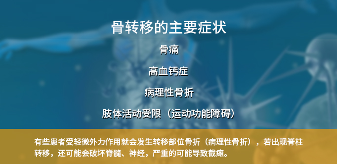 医学百科—癌症骨转移治疗
