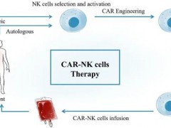 现货型CAR-NK治疗多种血液肿瘤和实体瘤完全缓解率达70%
