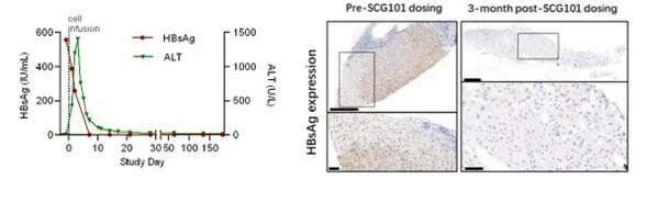 回输SCG101前后,HBsAg值变化