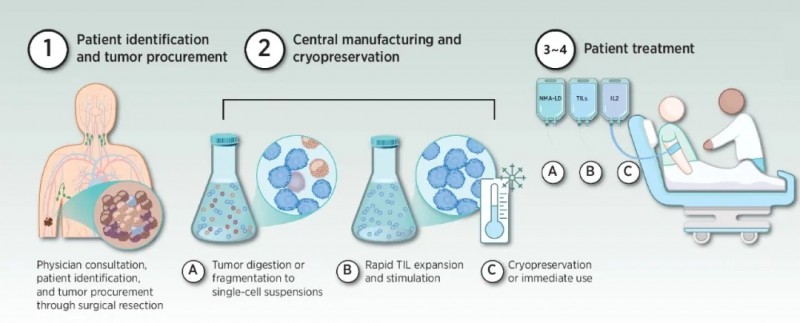 TIL疗法的主要治疗步骤