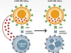 CAR-NK细胞免疫疗法治疗肺癌、胰腺癌、结直肠癌患者生存期翻倍