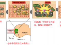 硼中子治疗30分钟击破肿瘤,硼中子俘获疗法深入细胞内部精准绝杀,让癌细胞无处遁形