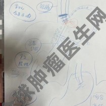 惊心动魄的12小时！胃癌患者术中2次追加切除区域，成功完成根治手术！