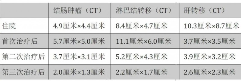 粪便移植联合免疫治疗转移性结直肠癌的效果