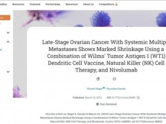 WT1-DC疫苗联合NK细胞疗法治疗卵巢癌,患者肿瘤明显缩小,腹水消退