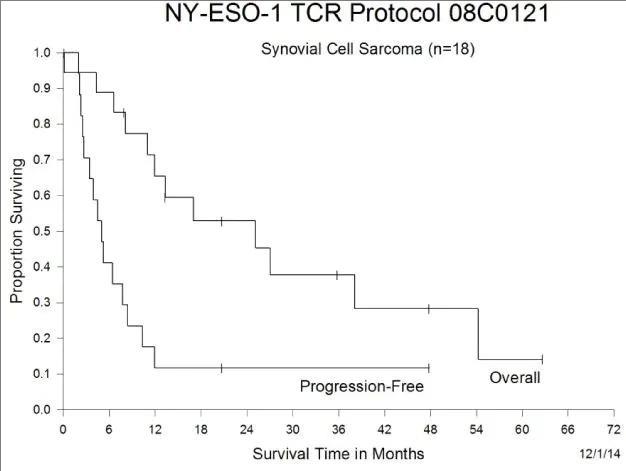 NY-ESO-1 TCR细胞疗法治疗18例滑膜肉瘤的数据