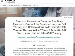 NK+WT-1 DC+α-Galcer DC三免疫疗法治疗胰腺癌,化疗耐药患者原发灶+转移灶双清零