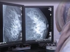 乳腺癌疫苗临床试验大获成功!75%患者成功激发超强免疫反应