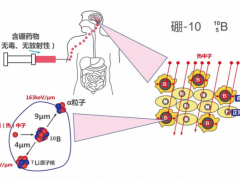 硼中子俘获疗法(BNCT)治疗乳腺癌,一种很有前景的乳腺癌放疗新技术