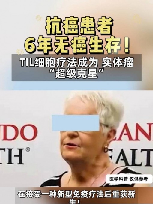 抗癌患者6年无癌生存，TIL疗法成为 实体瘤 “超级克星”#TIL疗法