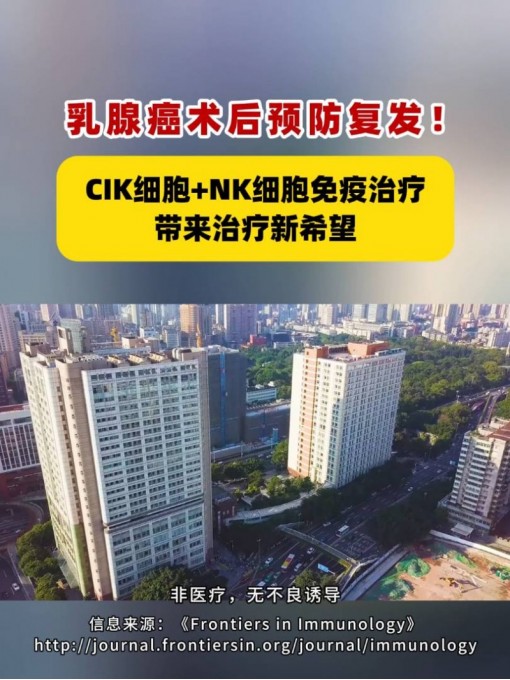 乳腺癌术后预防复发！CIK细胞+NK细胞免疫治疗带来治疗新希望 #乳腺癌 #CIK细胞