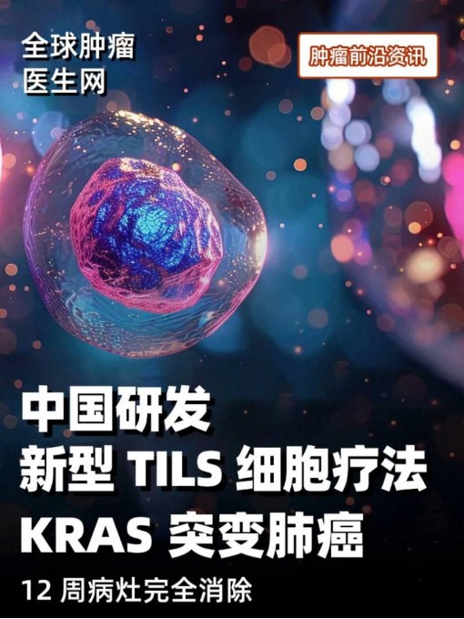 全球瞩目！中国研发新型 TIL 疗法成功实现 KRAS 突变肺癌病灶完全消除 #TILs细胞 #肺癌 #非小细胞肺癌