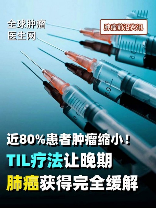 近80%患者肿瘤缩小！TIL疗法让晚期肺癌获得完全缓解 #TIL疗法 #肺癌