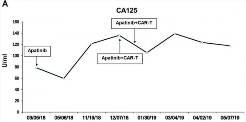 CART治疗卵巢的血浆CA125水平