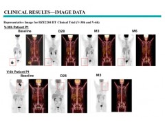 AACR 2025｜全球首创6小时极速制备：JL-闪CAR-T™助力短周期、低成本、长药效细胞药物开发